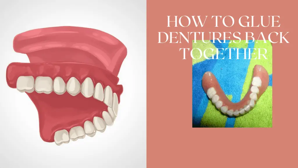 How To Glue Dentures Back Together?
