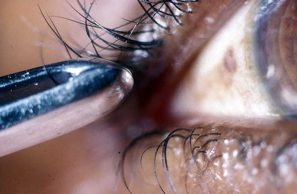 Use a tweezer to take the lashes off.